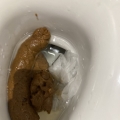大便