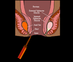 肛门腺位置示意图，图源：张健旭的科学网博客